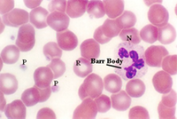  blood4.jpg (40969 bytes)