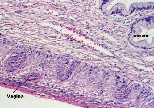 cervix2.jpg (266956 bytes)