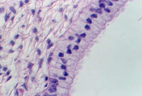 cervix3.jpg (61686 bytes)