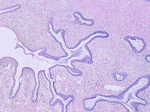 cervix5.jpg (195454 bytes)