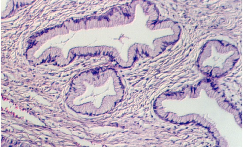 cervix.jpg (90446 bytes)