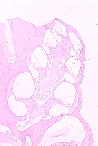 cochlea.jpg (42538 bytes)