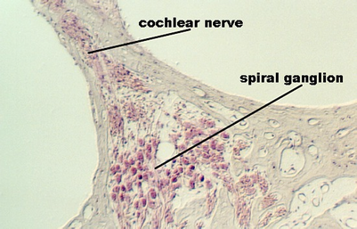cochlear_nerve1.jpg (69929 bytes)
