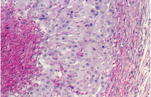 corpus hem.jpg (96889 bytes)