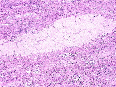 corpus_albicans1.jpg (197288 bytes)