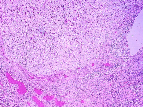 corpus_luteum.jpg (205957 bytes)