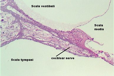 corti6.jpg (60531 bytes)