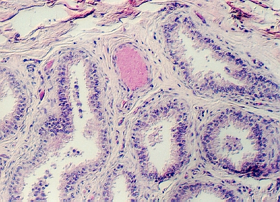 efferent2.jpg (189472 bytes)