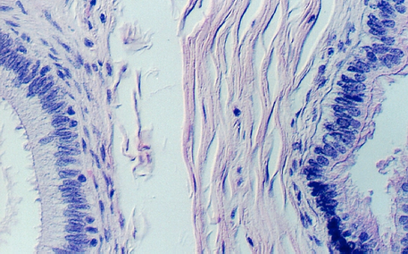 efferent6.jpg (296193 bytes)