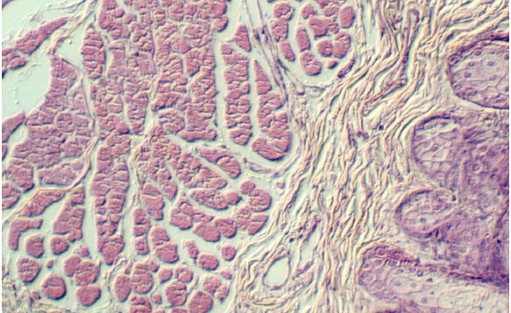 eyelid6.jpg (99271 bytes)