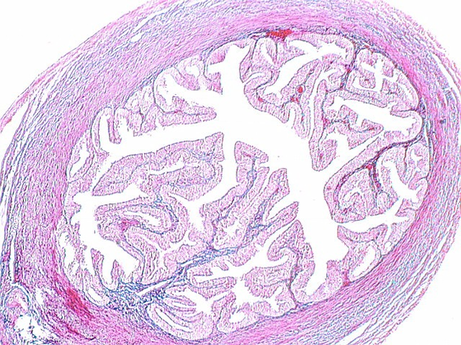 fallopian_tube3.jpg (191199 bytes)