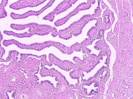 fallopian_tube5.jpg (205340 bytes)