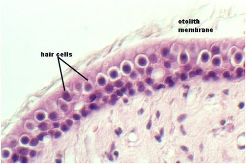 macula4.jpg (57903 bytes)