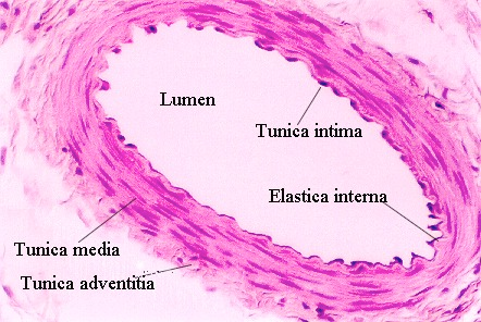 http://microanatomy.net/cardiovascular/MuscularA1.jpg