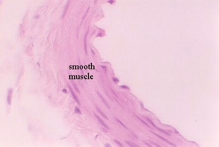 http://microanatomy.net/cardiovascular/MuscularA2.jpg