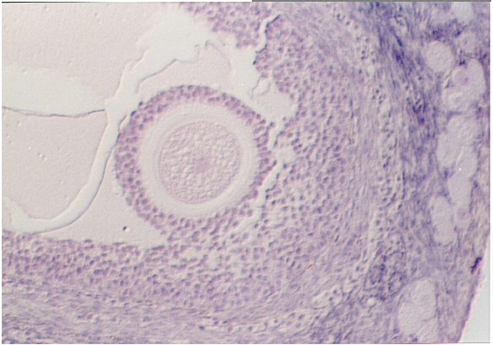 ovary11.jpg (64986 bytes)