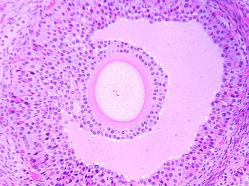 ovary1.jpg (123233 bytes)
