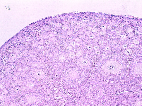 ovary2.jpg (161321 bytes)