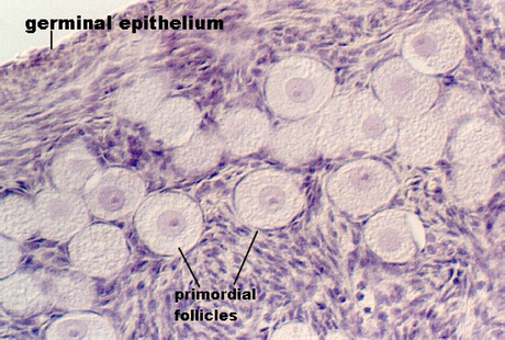 ovary7.jpg (101935 bytes)