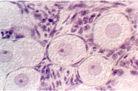 ovary8.jpg (86950 bytes)
