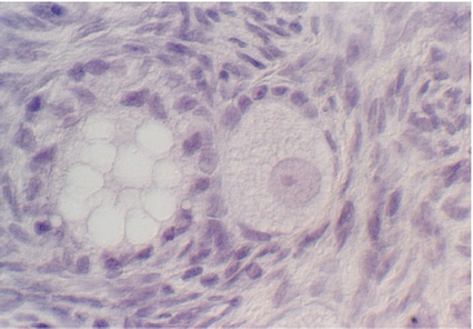 ovary9.jpg (62095 bytes)