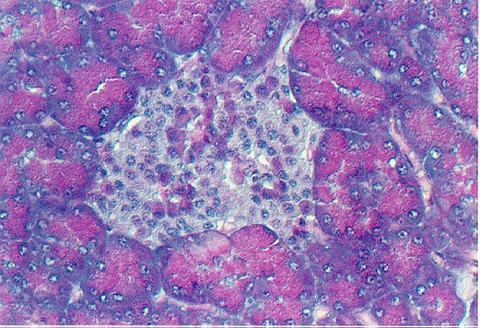 pancreas1.jpg (83347 bytes)