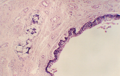 penis1.jpg (245662 bytes)