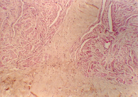 penis2.jpg (324534 bytes)