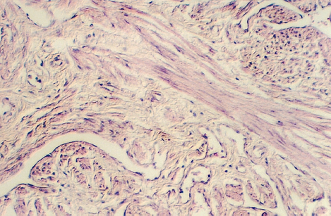 penis3.jpg (347228 bytes)