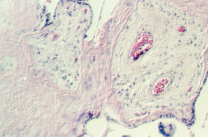 placenta_old2.jpg (67701 bytes)