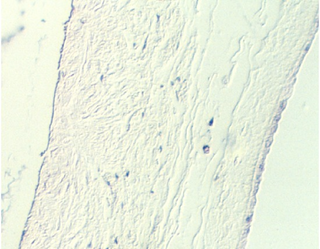 placenta_old3.jpg (65770 bytes)