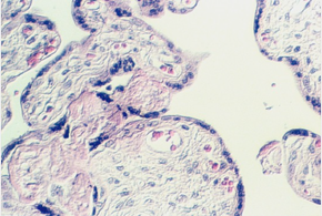 placenta_old5.jpg (79549 bytes)