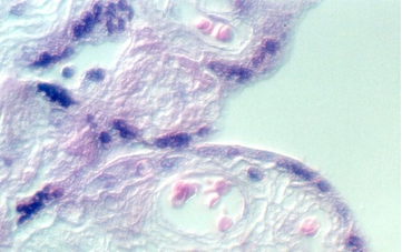 placenta_old6.jpg (57238 bytes)