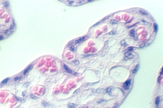 placenta_old7.jpg (54481 bytes)