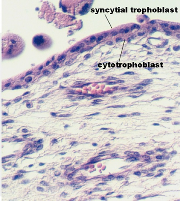 placenta_young4.jpg (111706 bytes)