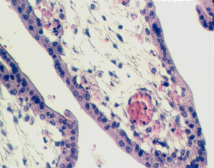 placenta_young5.jpg (72050 bytes)