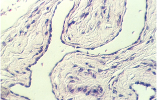 placenta_young7.jpg (83117 bytes)