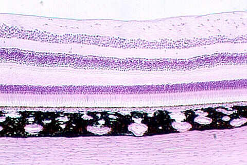 retina1.jpg (72400 bytes)