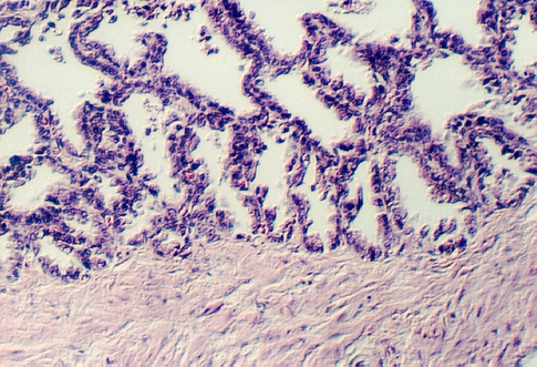 seminalv1.jpg (360773 bytes)