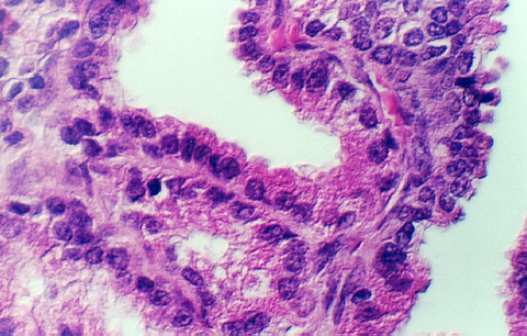 seminalv4.jpg (306228 bytes)