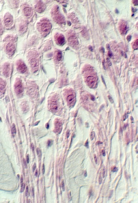 spiral_ganglion3.jpg (78963 bytes)