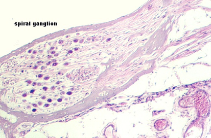 spiral_ganglion4.jpg (76115 bytes)