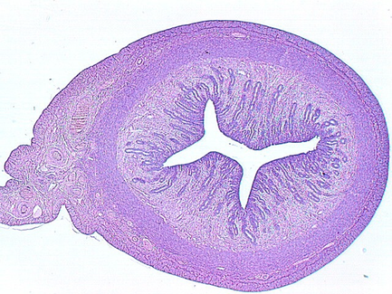 uterus1.jpg (169203 bytes)