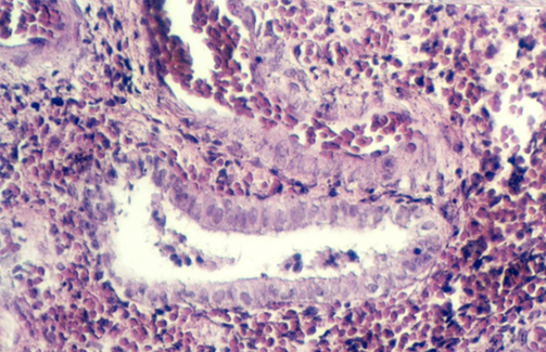 uterus_mens1.jpg (244409 bytes)