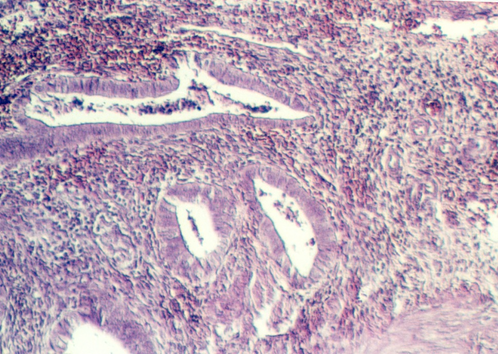 uterus_mens2.jpg (268349 bytes)