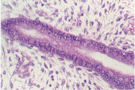 uterus_prol2.jpg (82540 bytes)