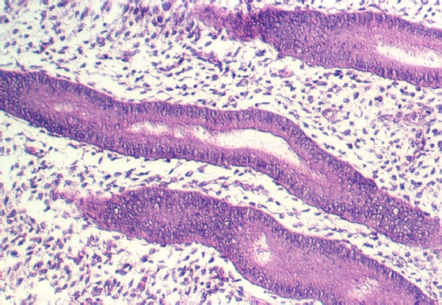 uterus_prol3.jpg (112920 bytes)