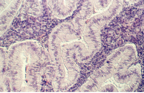 uterus_sec.jpg (94388 bytes)