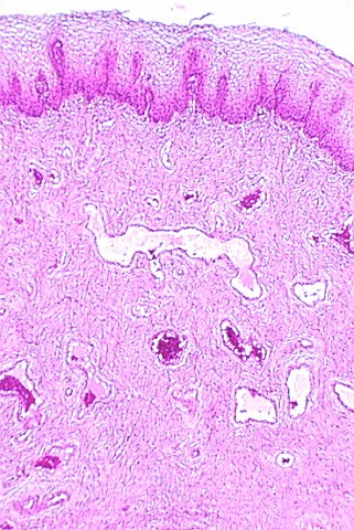 vagina1.jpg (94360 bytes)