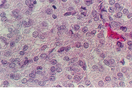 ypineal2.jpg (78240 bytes)